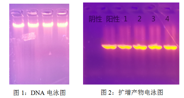 simgen-快速全血DNA小量试剂盒-2×PCR Mix -Sim-100超微量分光光度计- 电泳图