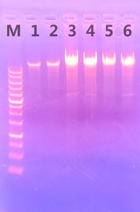 Simgem不同型号的样品裂解管研磨的酵母DNA电泳图