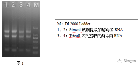 simgen-Simzol试剂-Trizol试剂-Buffer EX（可完美替换氯仿）-溶菌酶-Sim-100超微量分光光度计-电泳结果图1