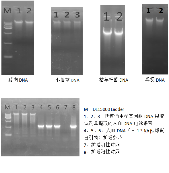 快速通用型基因组DNA提取试剂盒-2×PCR Mix-溶菌酶-电泳结果图一