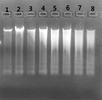 Simgen在1%的琼脂糖凝胶上加入5 μl洗脱的唾液DNA进行电泳结果图一