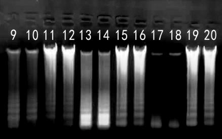 Simgen在1%的琼脂糖凝胶上加入5 μl洗脱的唾液DNA进行电泳结果图二