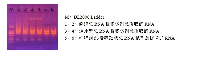 Simgen超纯总RNA提取试剂盒—电泳条带